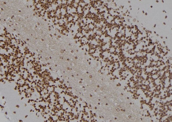 HOXC8 Antibody - 1:100 staining rat brain tissue by IHC-P. The sample was formaldehyde fixed and a heat mediated antigen retrieval step in citrate buffer was performed. The sample was then blocked and incubated with the antibody for 1.5 hours at 22°C. An HRP conjugated goat anti-rabbit antibody was used as the secondary.