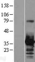HOXC8 Protein - Western validation with an anti-DDK antibody * L: Control HEK293 lysate R: Over-expression lysate