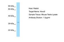 HOXC9 Antibody -  This image was taken for the unconjugated form of this product. Other forms have not been tested.
