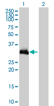 HOXC9 Antibody - Western Blot analysis of HOXC9 expression in transfected 293T cell line by HOXC9 monoclonal antibody (M01), clone 2B12.Lane 1: HOXC9 transfected lysate(29.9 KDa).Lane 2: Non-transfected lysate.