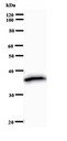 HOXC9 Antibody - Western blot of immunized recombinant protein using HOXC9 antibody.