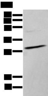 HOXC9 Antibody - Western blot analysis of TM4 cell lysate  using HOXC9 Polyclonal Antibody at dilution of 1:350