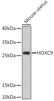 HOXC9 Antibody - Western blot analysis of extracts of Mouse uterus using HOXC9 Polyclonal Antibody at dilution of 1:1000.
