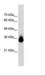 HOXC9 Antibody - Transfected 293T Cell Lysate.  This image was taken for the unconjugated form of this product. Other forms have not been tested.