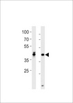 HOXD1 Antibody - DANRE hoxa1a Antibody western blot of zebra fish brain and heart tissue lysates (35 ug/lane). The DANRE hoxa1a antibody detected the DANRE hoxa1a protein (arrow).