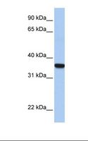 HOXD1 Antibody - Fetal liver lysate. Antibody concentration: 1.0 ug/ml. Gel concentration: 12%.  This image was taken for the unconjugated form of this product. Other forms have not been tested.