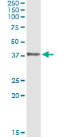 HOXD1 Antibody - Immunoprecipitation of HOXD1 transfected lysate using anti-HOXD1 monoclonal antibody and Protein A Magnetic Bead, and immunoblotted with HOXD1 rabbit polyclonal antibody.