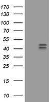 HOXD10 Antibody - HEK293T cells were transfected with the pCMV6-ENTRY control (Left lane) or pCMV6-ENTRY HOXD10 (Right lane) cDNA for 48 hrs and lysed. Equivalent amounts of cell lysates (5 ug per lane) were separated by SDS-PAGE and immunoblotted with anti-HOXD10.