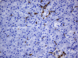 HOXD10 Antibody - IHC of paraffin-embedded Human pancreas tissue using anti-HOXD10 mouse monoclonal antibody. (Heat-induced epitope retrieval by 10mM citric buffer, pH6.0, 120°C for 3min).