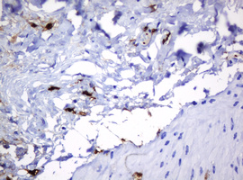 HOXD10 Antibody - IHC of paraffin-embedded Human bladder tissue using anti-HOXD10 mouse monoclonal antibody. (Heat-induced epitope retrieval by 10mM citric buffer, pH6.0, 120°C for 3min).
