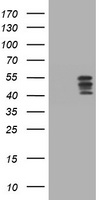 HOXD10 Antibody - HEK293T cells were transfected with the pCMV6-ENTRY control (Left lane) or pCMV6-ENTRY HOXD10 (Right lane) cDNA for 48 hrs and lysed. Equivalent amounts of cell lysates (5 ug per lane) were separated by SDS-PAGE and immunoblotted with anti-HOXD10.