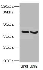 HOXD10 Antibody - Western blot All Lanes: HOXD10 antibody at 3.21ug/ml Lane 1: Mouse liver tissue Lane 2: Mouse gonadal tissue Secondary Goat polyclonal to Rabbit IgG at 1/10000 dilution Predicted band size: 38 kDa Observed band size: 38 kDa