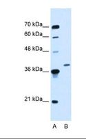 HOXD11 Antibody - HepG2 cell lysate. Antibody concentration: 0.25 ug/ml. Gel concentration: 12%.  This image was taken for the unconjugated form of this product. Other forms have not been tested.