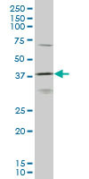 HOXD11 Antibody - HOXD11 monoclonal antibody (M10), clone 6C8 Western blot of HOXD11 expression in K-562.