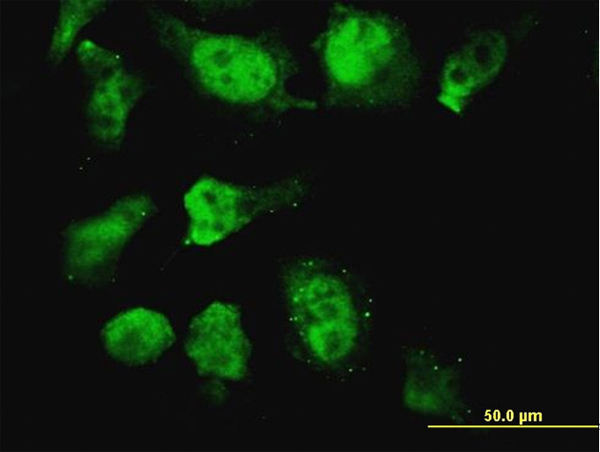 HOXD11 Antibody - Immunofluorescence of monoclonal antibody to HOXD11 on HeLa cell. [antibody concentration 10 ug/ml]