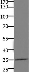 HOXD11 Antibody - Western blot analysis of Mouse kidney tissue, using HOXD11 Polyclonal Antibody at dilution of 1:1100.