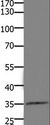 HOXD11 Antibody - Western blot analysis of Mouse kidney tissue, using HOXD11 Polyclonal Antibody at dilution of 1:1100.
