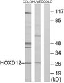 HOXD12 Antibody - Western blot analysis of lysates from COLO205 and HucEc cells, treated with serum 20% 15', using HOXD12 Antibody. The lane on the right is blocked with the synthesized peptide.