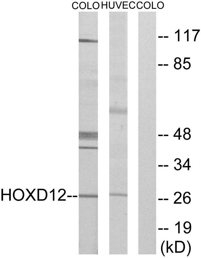 HOXD12 Antibody - Western blot analysis of lysates from COLO205 and HucEc cells, treated with serum 20% 15', using HOXD12 Antibody. The lane on the right is blocked with the synthesized peptide.