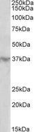 HOXD12 Antibody - HOXD12 antibody (2 ug/ml) staining of Human Heart lysate (35 ug protein in RIPA buffer). Primary incubation was 1 hour. Detected by chemiluminescence.
