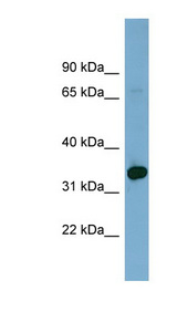 HOXD12 Antibody - HOXD12 antibody Western blot of COLO205 cell lysate. This image was taken for the unconjugated form of this product. Other forms have not been tested.