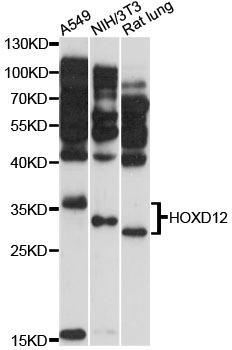 HOXD12 Antibody - Western blot analysis of extracts of various cell lines, using HOXD12 antibody at 1:3000 dilution. The secondary antibody used was an HRP Goat Anti-Rabbit IgG (H+L) at 1:10000 dilution. Lysates were loaded 25ug per lane and 3% nonfat dry milk in TBST was used for blocking. An ECL Kit was used for detection and the exposure time was 60s.