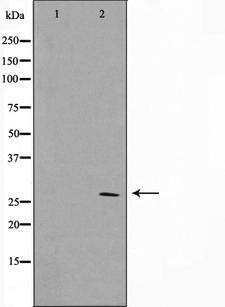 HOXD12 Antibody - Western blot analysis on COLO205 cell lysates using HOXD12 antibody. The lane on the left is treated with the antigen-specific peptide.