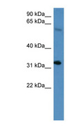 HOXD13 Antibody - HOXD13 antibody Western blot of Mouse Spleen lysate. This image was taken for the unconjugated form of this product. Other forms have not been tested.