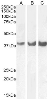HOXD13 Antibody - Goat anti-HOXD13 Antibody (0.3µg/ml) staining of Human (A), Mouse (B) and (0.1ug/ml) Rat (C) Brain lysate (35µg protein in RIPA buffer). Detected by cemiluminescence.