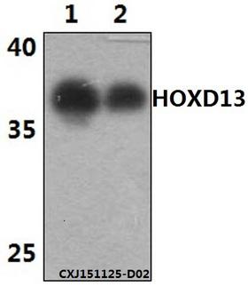 HOXD13 Antibody - Western blot of HOXD13 polyclonal antibody at 1:500 dilution. Lane 1: The brain tissue lysate of Mouse(30 ug). Lane 2: The brain tissue lysate of Rat(30 ug).