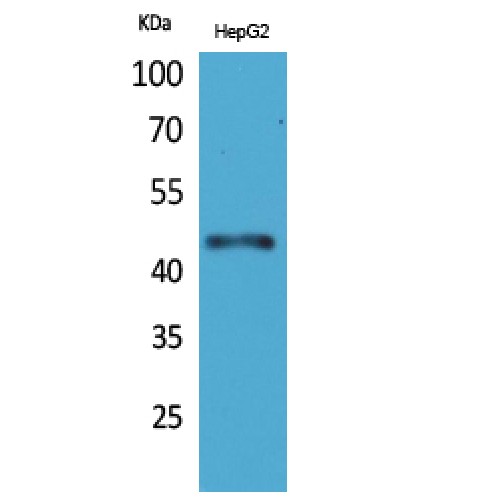 HOXD3 Antibody - Western blot of HoxD3 antibody