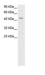 HOXD3 Antibody - Jurkat Cell Lysate.  This image was taken for the unconjugated form of this product. Other forms have not been tested.
