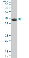 HOXD3 Antibody - HOXD3 monoclonal antibody (M09), clone 1B12. Western Blot analysis of HOXD3 expression in HeLa NE.