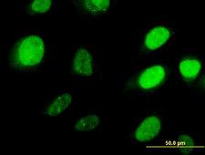 HOXD3 Antibody - Immunofluorescence of monoclonal antibody to HOXD3 on HeLa cell . [antibody concentration 10 ug/ml]