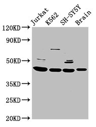 HOXD3 Antibody - Positive Western Blot detected in Jurkat whole cell lysate, K562 whole cell lysate, SH-SY5Y whole cell lysate, Rat brain tissue. All lanes: HOXD3 antibody at 8.5 µg/ml Secondary Goat polyclonal to rabbit IgG at 1/50000 dilution. Predicted band size: 46 KDa. Observed band size: 46 KDa
