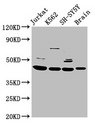HOXD3 Antibody - Positive Western Blot detected in Jurkat whole cell lysate, K562 whole cell lysate, SH-SY5Y whole cell lysate, Rat brain tissue. All lanes: HOXD3 antibody at 8.5 µg/ml Secondary Goat polyclonal to rabbit IgG at 1/50000 dilution. Predicted band size: 46 KDa. Observed band size: 46 KDa