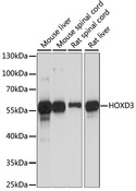 HOXD3 Antibody - Western blot analysis of extracts of various cell lines, using HOXD3 antibody at 1:1000 dilution. The secondary antibody used was an HRP Goat Anti-Rabbit IgG (H+L) at 1:10000 dilution. Lysates were loaded 25ug per lane and 3% nonfat dry milk in TBST was used for blocking. An ECL Kit was used for detection and the exposure time was 90S.