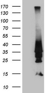 HOXD4 Antibody - HEK293T cells were transfected with the pCMV6-ENTRY control. (Left lane) or pCMV6-ENTRY HOXD4. (Right lane) cDNA for 48 hrs and lysed