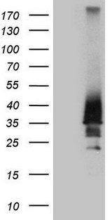 HOXD4 Antibody - HEK293T cells were transfected with the pCMV6-ENTRY control. (Left lane) or pCMV6-ENTRY HOXD4. (Right lane) cDNA for 48 hrs and lysed. Equivalent amounts of cell lysates. (5 ug per lane) were separated by SDS-PAGE and immunoblotted with anti-HOXD4. (1:2000)