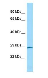 HOXD4 Antibody - HOXD4 antibody Western Blot of Rat Pancreas.  This image was taken for the unconjugated form of this product. Other forms have not been tested.