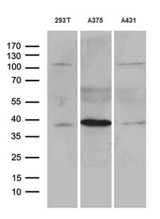 HOXD8 Antibody - Western blot analysis of extracts. (35ug) from 3 cell lines by using anti-HOXD8 monoclonal antibody. (1:500)
