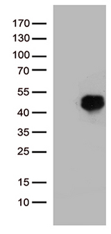 HOXD8 Antibody - HEK293T cells were transfected with the pCMV6-ENTRY control. (Left lane) or pCMV6-ENTRY HOXD8. (Right lane) cDNA for 48 hrs and lysed. Equivalent amounts of cell lysates. (5 ug per lane) were separated by SDS-PAGE and immunoblotted with anti-HOXD8. (1:2000)