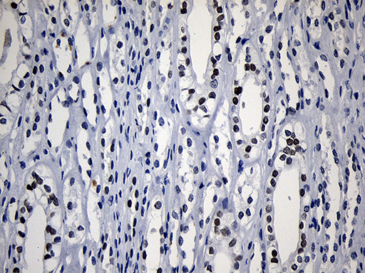 HOXD8 Antibody - Immunohistochemical staining of paraffin-embedded Human Kidney tissue within the normal limits using anti-HOXD8 mouse monoclonal antibody. (Heat-induced epitope retrieval by 1mM EDTA in 10mM Tris buffer. (pH8.5) at 120°C for 3 min. (1:500)