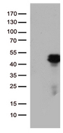 HOXD8 Antibody - HEK293T cells were transfected with the pCMV6-ENTRY control. (Left lane) or pCMV6-ENTRY HOXD8. (Right lane) cDNA for 48 hrs and lysed. Equivalent amounts of cell lysates. (5 ug per lane) were separated by SDS-PAGE and immunoblotted with anti-HOXD8. (1:500)
