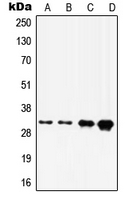 HOXD8 Antibody - Western blot analysis of HOXD8 expression in A375 (A); A431 (B); HepG2 (C); HeLa (D) whole cell lysates.