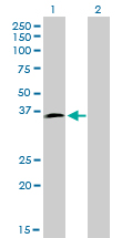 HOXD8 Antibody - Western Blot analysis of HOXD8 expression in transfected 293T cell line by HOXD8 monoclonal antibody (M01), clone 10F8.Lane 1: HOXD8 transfected lysate(31.8 KDa).Lane 2: Non-transfected lysate.