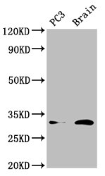 HOXD8 Antibody - Positive Western Blot detected in PC3 whole cell lysate, Mouse brain tissue. All lanes: HOXD8 antibody at 4.5 µg/ml Secondary Goat polyclonal to rabbit IgG at 1/50000 dilution. Predicted band size: 32, 9 KDa. Observed band size: 32 KDa
