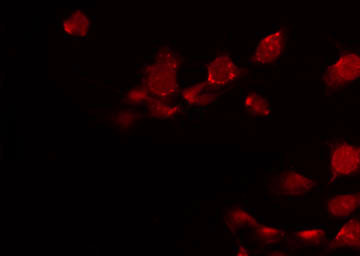 HOXD8 Antibody - Staining HeLa cells by IF/ICC. The samples were fixed with PFA and permeabilized in 0.1% Triton X-100, then blocked in 10% serum for 45 min at 25°C. The primary antibody was diluted at 1:200 and incubated with the sample for 1 hour at 37°C. An Alexa Fluor 594 conjugated goat anti-rabbit IgG (H+L) Ab, diluted at 1/600, was used as the secondary antibody.
