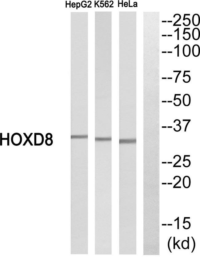 HOXD8 Antibody - Western blot analysis of extracts from HepG2 cells, K562 cells and HeLa cells, using HOXD8 antibody.