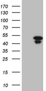 HOXD9 Antibody - HEK293T cells were transfected with the pCMV6-ENTRY control. (Left lane) or pCMV6-ENTRY HOXD9. (Right lane) cDNA for 48 hrs and lysed. Equivalent amounts of cell lysates. (5 ug per lane) were separated by SDS-PAGE and immunoblotted with anti-HOXD9. (1:2000)